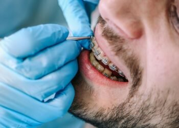 What Is Early Interceptive Orthodontic Treatment