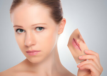 Platysmaplasty Procedure