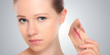 Platysmaplasty Procedure